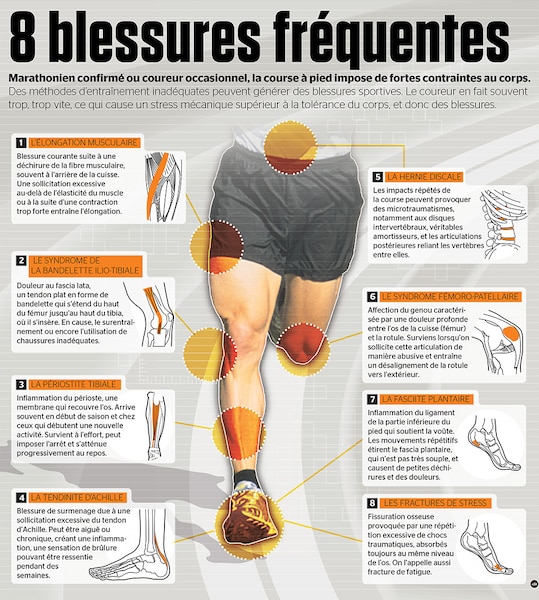 Blessure course type 2