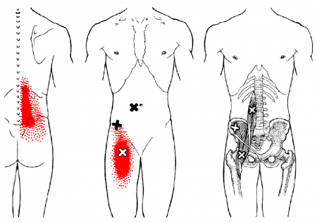 Psoas